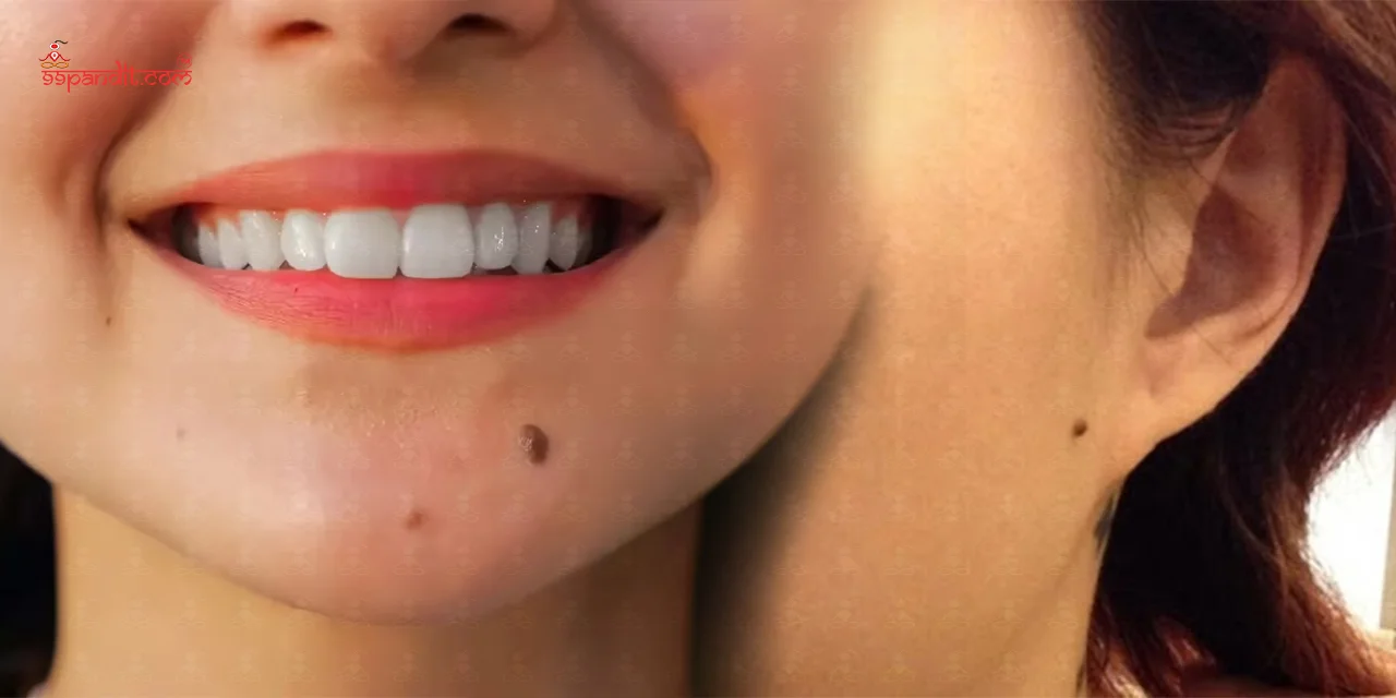 Moles on Body