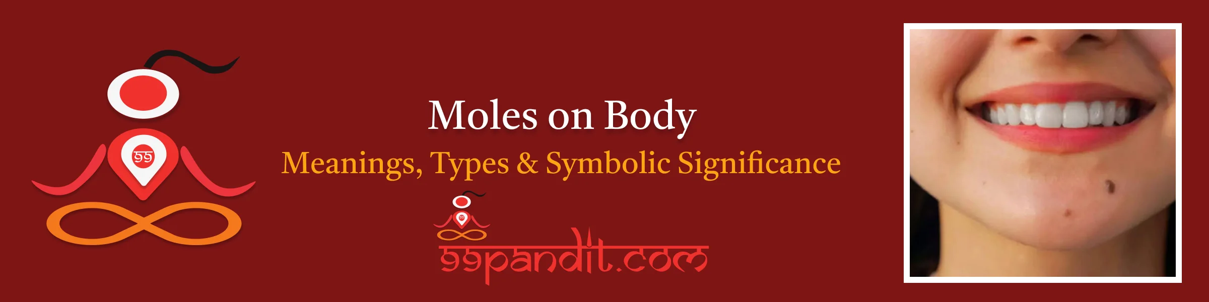 Moles on Body